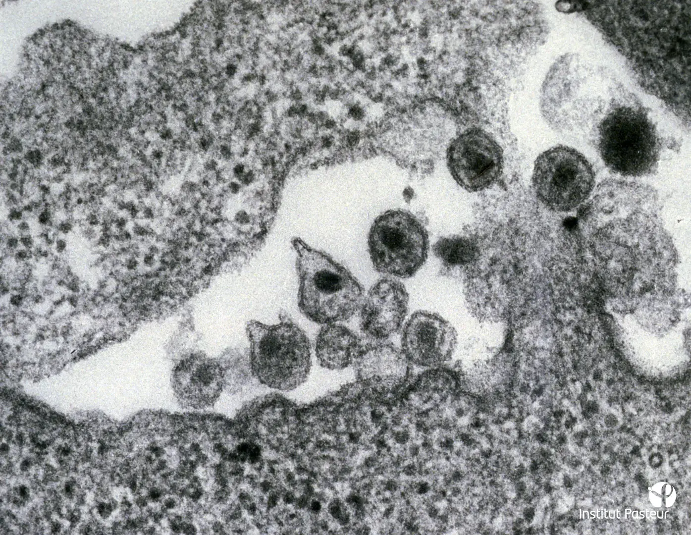 Une des premières photographies du virus VIH-1 