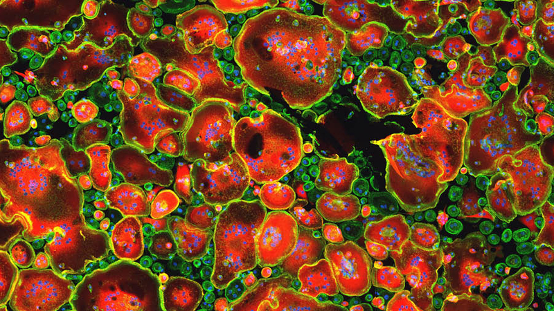 Macrophages humains infectés par le VIH, marqués en immunofluorescence