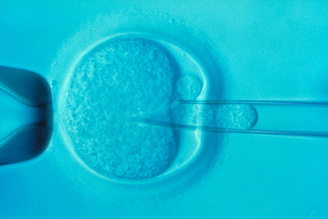 Foetus de lapin âgés de 13 jours,non transgéniques