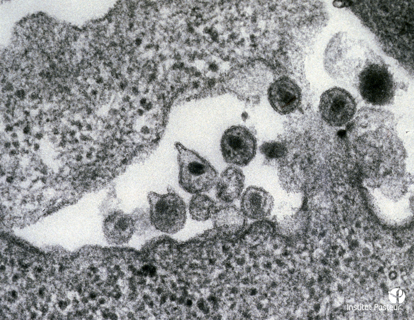 Une des premières photographies du virus VIH-1 